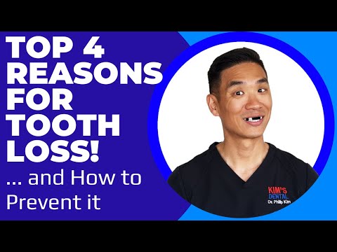 Top 4 Reasons for Tooth Loss! ... And How To Prevent It