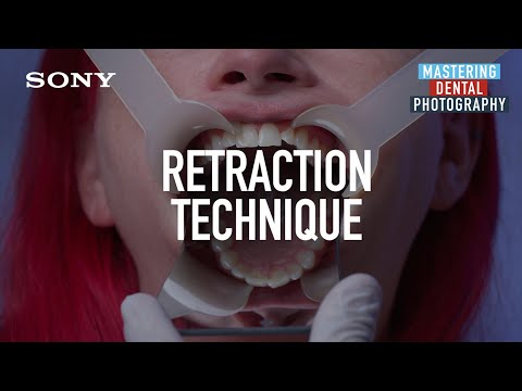 Dental Photography: Retraction Technique