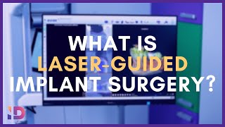 What is Laser-guided Implant Surgery? | Integrated Dentalcare #edinburgh #dentist #technology