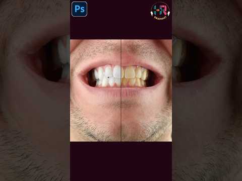 How to do Whitten Teeth in #photoshop #editing #logo #tutorial #learning #shortsfeed #colour #shorts