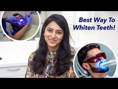 Fastest way to Whiten Teeth : Dentist explains. Is Teeth Whitening Good For You?