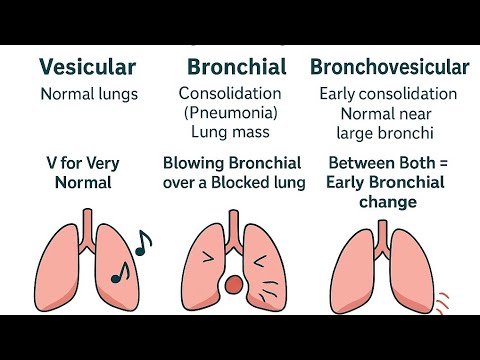 Normal vs abnormal lungs sound|MEMORY TRICK|NEET MDS #shortsfeed #doctor #shortvideo#lunghealth