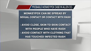 Probable case of monkeypox found in Allen County