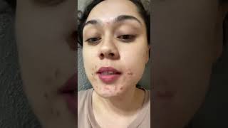 Face Transformation! Used Curology for my breakouts