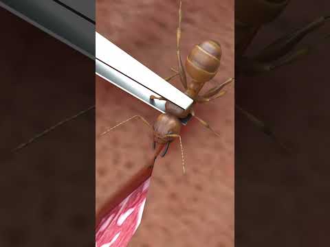 African Soldiers Using Ants To Stitch Wounds 🐜