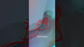 Why Flossing Causes Bleeding Gums 😬