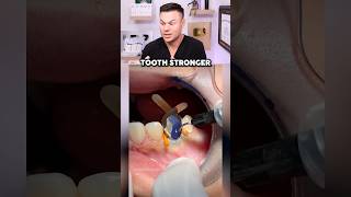 Dentist Shows A Total Tooth RESTORATION! 😮🦷