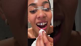 Proven Solution To Fix Your Smile #teethwhitening #teethwhitener #healthysmile #beauty