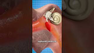 Can Holding In A Sneeze Kill You? 🤔 #zachdfilms #shorts