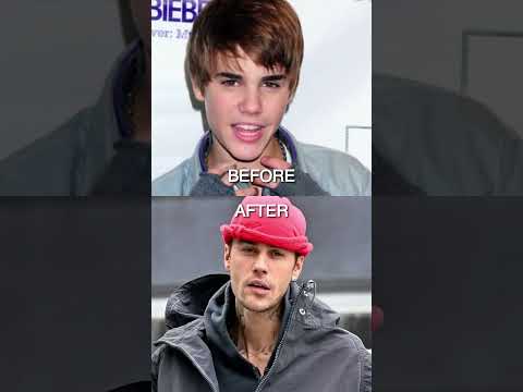How Justin Bieber Changed His Whole Life ✨