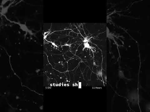 Myth: A Bigger Brain Means More Intelligence #neuroscience #psychology #brain #size #doessizematter
