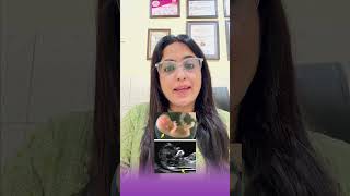 Importance Of NT Scan In Pregnancy #pregnancy #ntscan @nishajethani7223