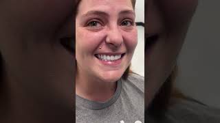 Ashley | Affordable Dentures & Implants Moments