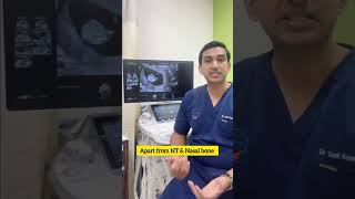 First Trimester NT Scan — Why It Matters & What We See? | Dr Sunil Kumar G S | #ntscan #pregnancy