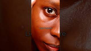 Eye serum (🎁) #koreanskincare #axisy #axisyeyeserum #axisyglowserum #axisyserum #kbeautyskincare