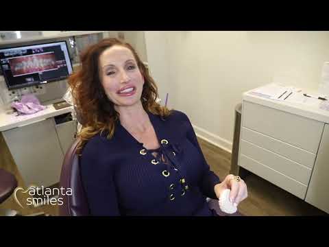 Am I a Good Candidate for Veneers?