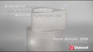 Understand How to Utilize an Implant Scan Body for an Accurate Digital Impression