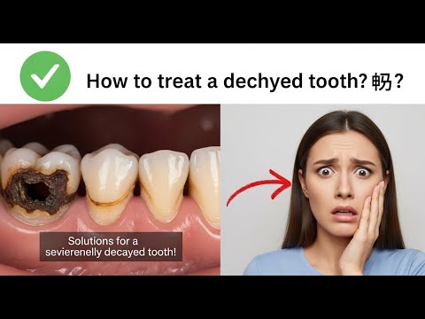 ✅ Solutions for a severely decayed tooth! 🦷 / How to treat a decayed tooth? 👈😳