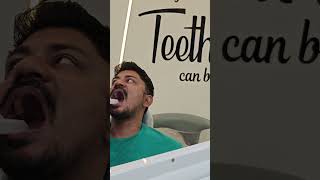 Digital impression (measurement) for dental implant crown prosthesis! #dentalexpertsbhopal