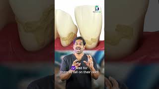 Are only the first four lower teeth mobile? - Mobile lower anteriors? | Dr.Karthikeyan | Denta Kings
