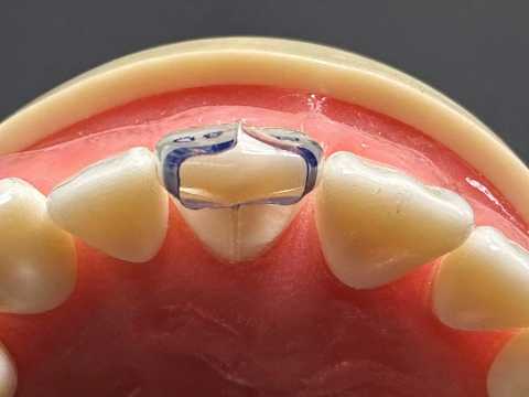 World’s First Truly Anatomical Matrix | Bioclear TSS