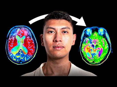 The ONE Mindset Hack That Made Me $31.8M, Yours Free