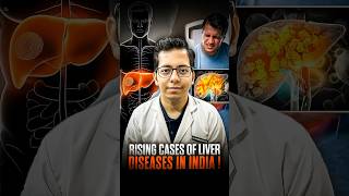 Rising Cases of Liver Diseases in India | Dt.Bhawesh | #diettubeindia #dietitian #liverdetox #shorts