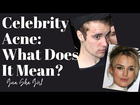 Celebrity Acne: Justin Bieber, Keira Knightley and MORE!