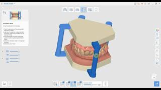 Model Builder in Medit Link basics