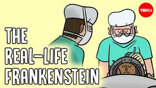 One surgeon's obsession with head transplants - Max G. Levy