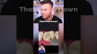 Why You Should BRUSH Your Teeth! 🦷🪥