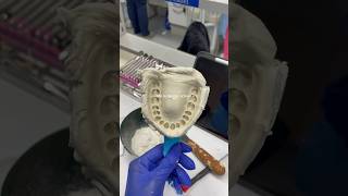 the art of dentistry 🦷✨ #dentalschool #dentalschools #dentalstudent #dentalstudents #studentdentist