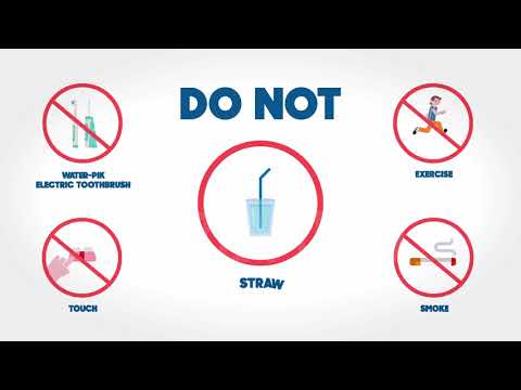 Post Extraction Instructions