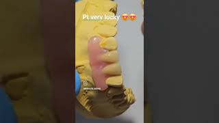 very lucky pt I made for Australian pt #dentistry #dentist #dentalwork #denture