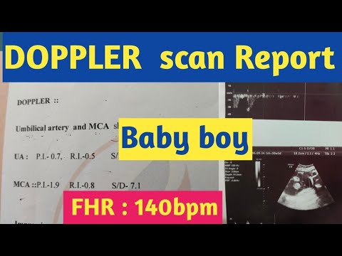 DOPPLER scan report of baby boy|| 30 weeks baby boy scan report| #DOPPLER #pregnancy