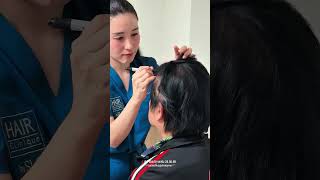 หนุ่มสันติสุข สุดช้ำ! เมื่อก่อนผมแน่นเต็มตอนนี้แบบว่า #รีวิวปลูกผมHairClinique #HairCliniquebySLC
