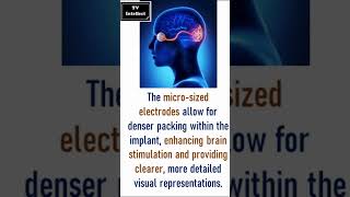 Breakthrough Vision Implant Uses Neuron-Sized Electrodes to Restore Sight | TV Intellect