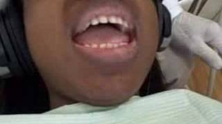 Beautiful Smile Enhancement closing spaces