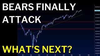 Bears Make First Attack Will It Be Meaningful?