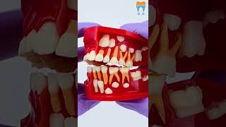 iDENTical Pediatric Development Model Age 5-9 M7012 #shorts #dentalkart