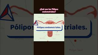 ✨¿Qué son los pólipos endometriales? #poliposendometriales #sabiasque #ginecologia #medicinaenlared