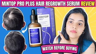 Mintop Pro Plus Hair Regrowth Serum Review – Stop Hair Fall & Regrow Hair? Worth It or Hype?