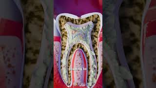 How A Tooth Abscess Develops 😬