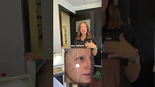 BBL Forever Clear for Acne | Dr. Garramone