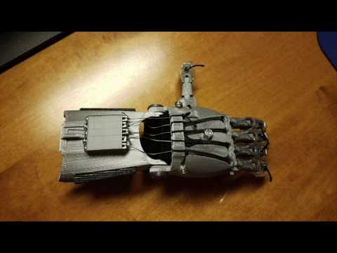 3D Print a Working Prosthetic Hand!