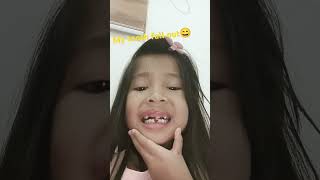 my tooth fall out