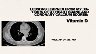 Lessons Learned from Thirty Years CT Heart Scans and Coronary Calcium Scores: The Role of Vitamin D