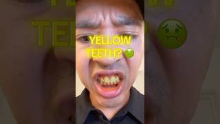 how i whiten my teeth daily with @GuruNanda 💯👍 #dental #dentalcare #shorts