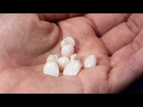 FAQ - What are veneers and how do they work? | Friendswood Dental