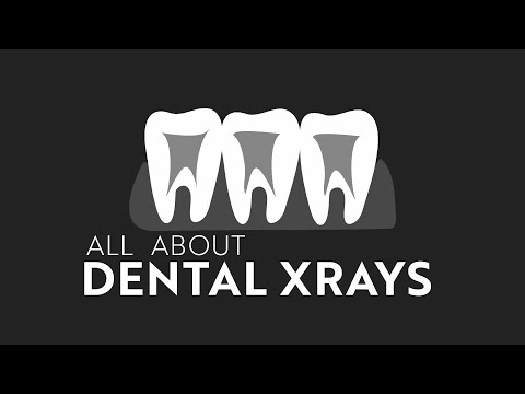 All About Dental X Rays